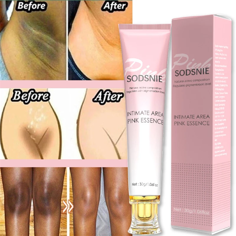 

Effective Whitening Intimate Area Pink Serum Care Private Parts Skin Remove Melanin Armpits Elbow Knee Body Dull Brighten Scrub
