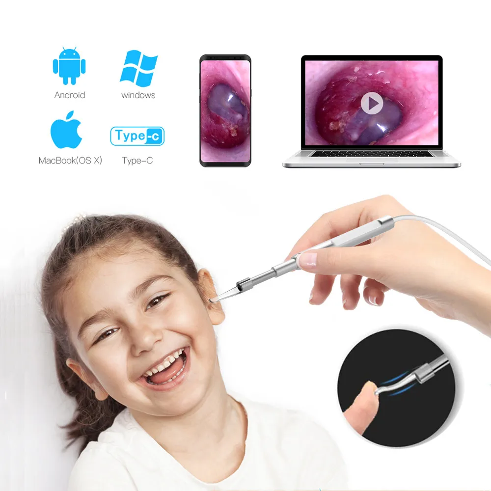 

3.9mm Otoscope Medical Ear Scope Endoscope Otoscopio Digital Earwax Cleaner Camera with Screen for Ears Nose Dental Inspect