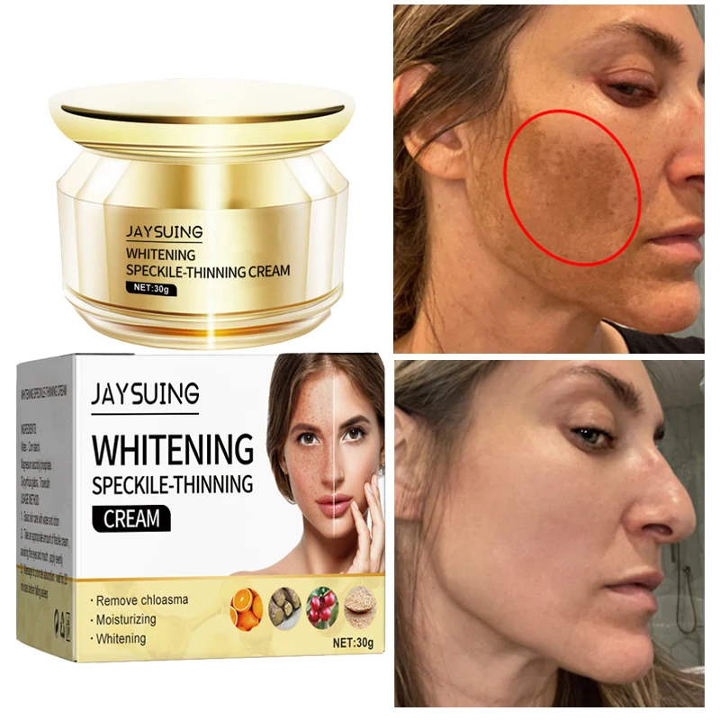 

Whitening Freckle Cream Effective Remove Melasma Cream Dark Spots Remover Melanin Improve Dullness Moisturize Brighten Skin Care