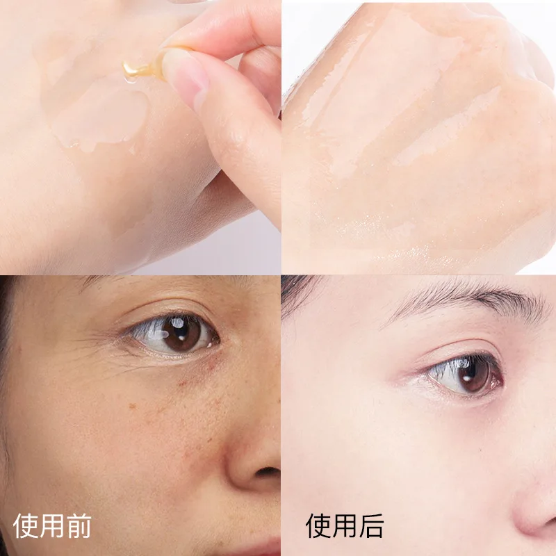 20/50/60/100Pcs Hyaluronic Acid Capsules Serum Spot Acne Remover Whitening Cream Anti-Wrinkle Ageless TSLM1 |