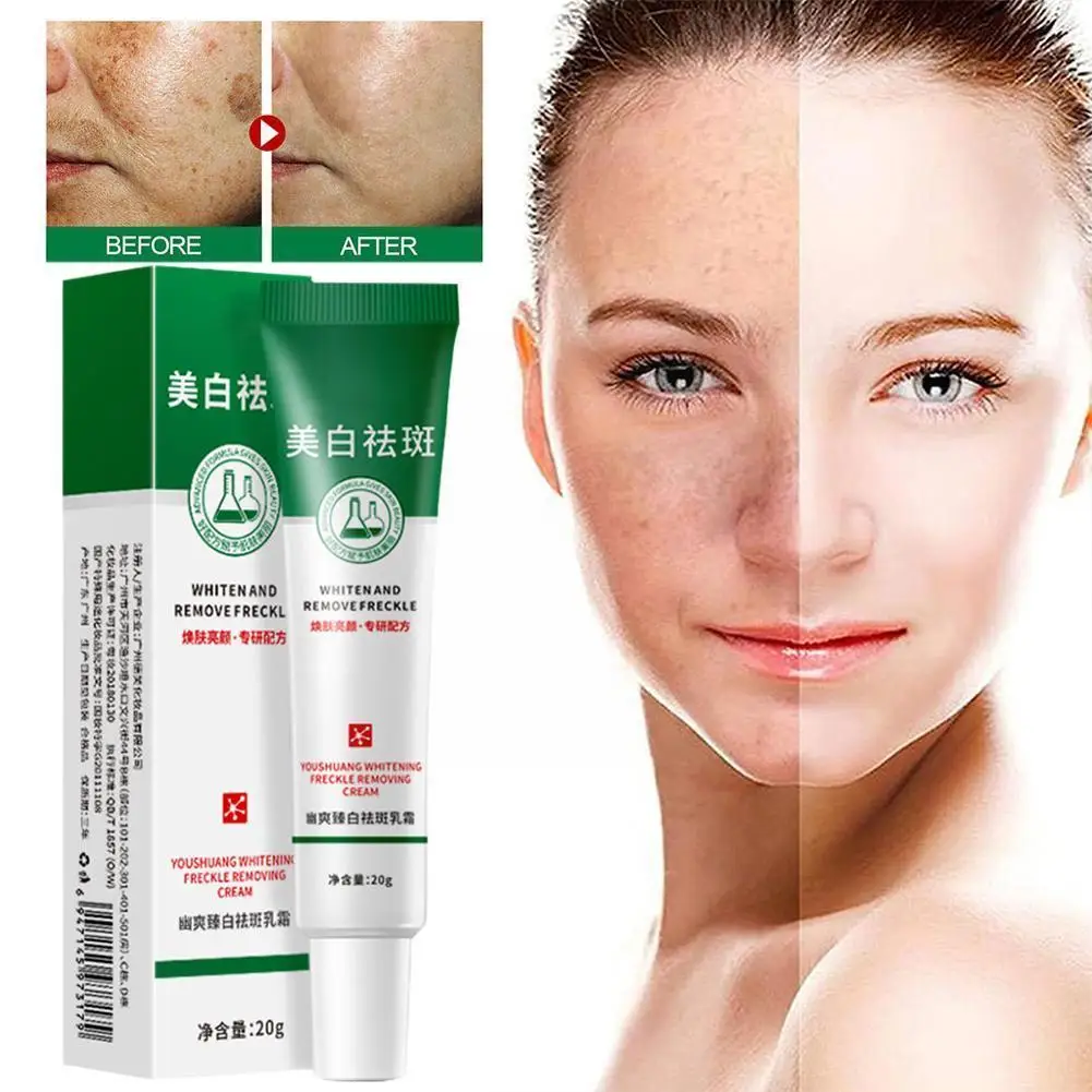 

Whitening Freckles Cream Remove Melasma Fade Improve Dullness Products Anti-aging Skin Moisturize Facial Brighten Care M4U7