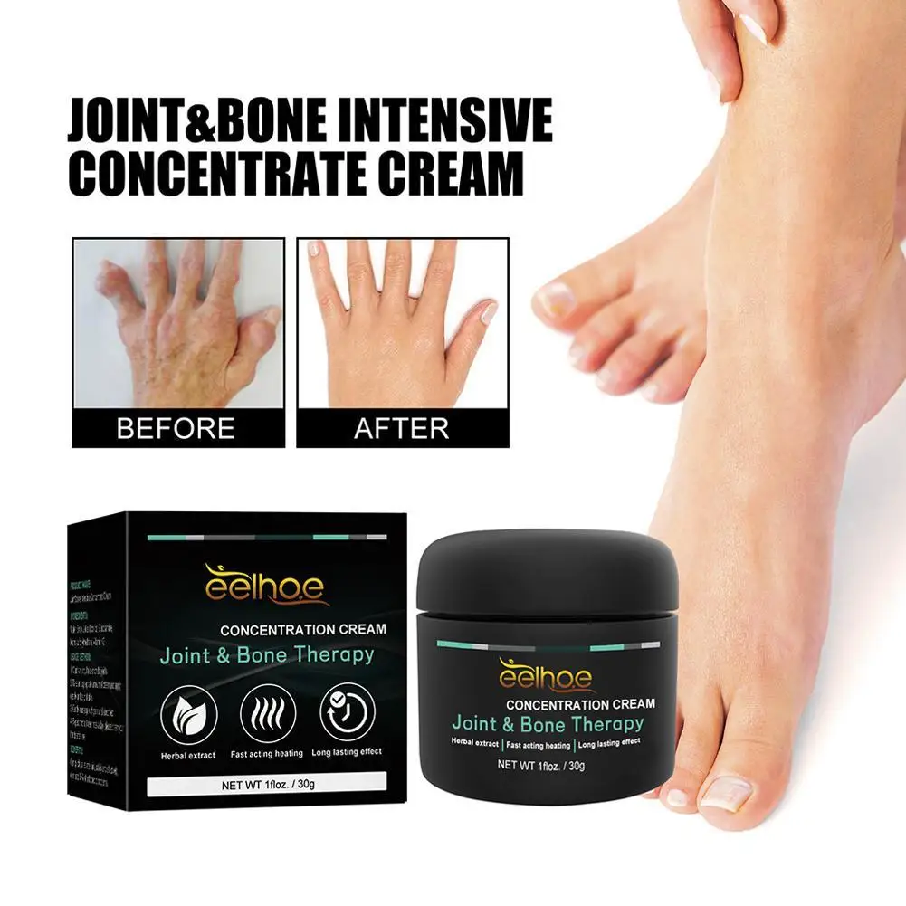 

Rheumatoid Arthrosis Cream Promotes Soft Tissue Repair Discomfort Relief Arthrosis Cream Make Skin Gentle For Men Women