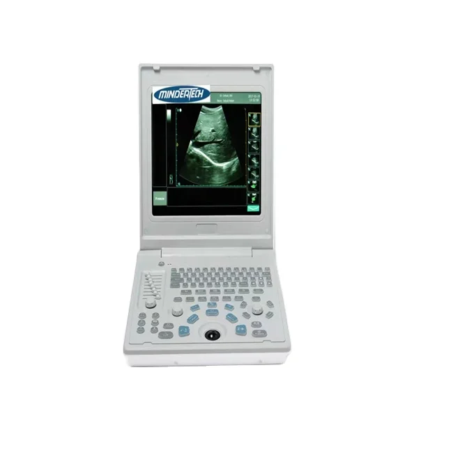 

Mta1c Ultrasound Diagnostic Machine Handheld Colour Doppler Dog Ultrasound scanne For Vet Hospital/clinic