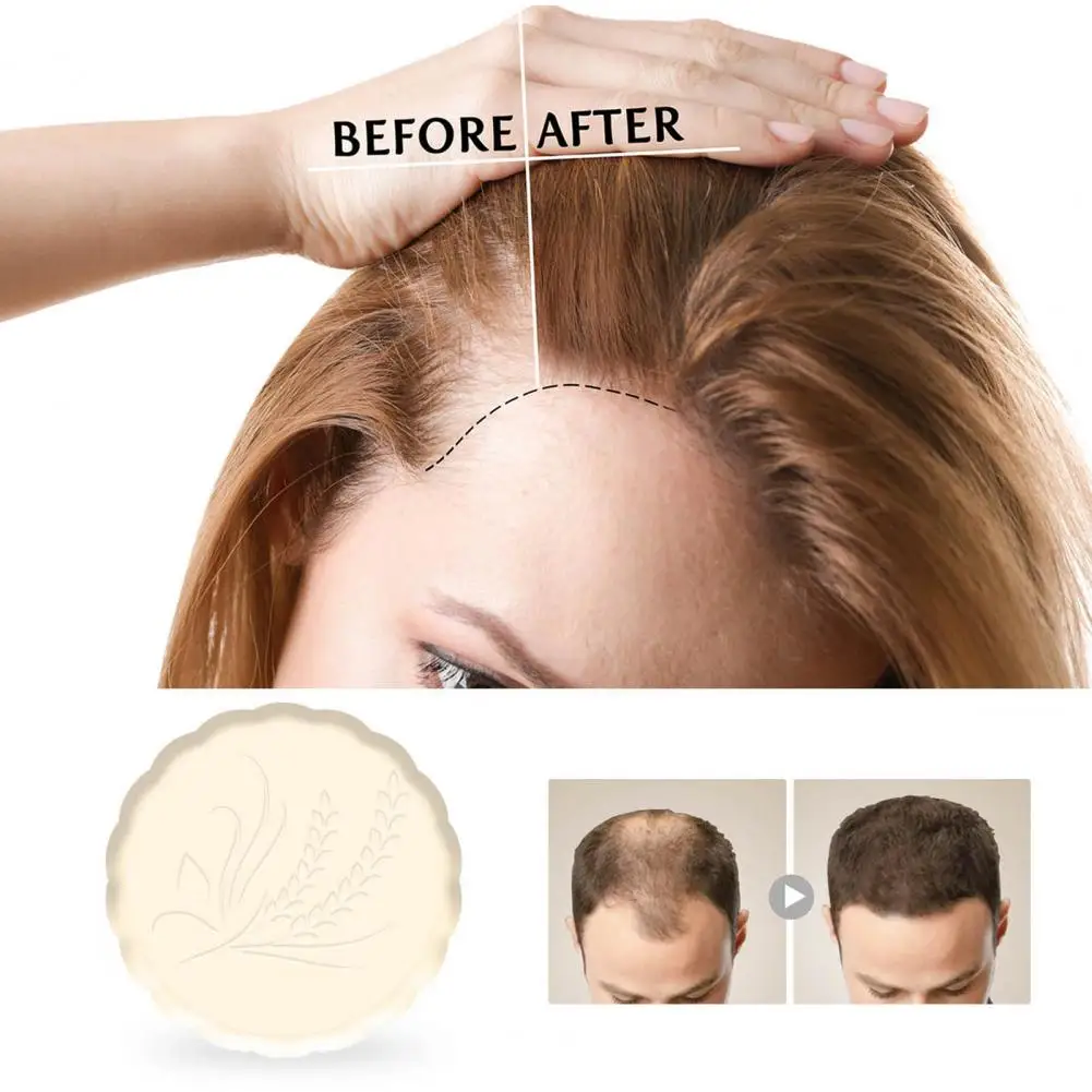 

Hair Soap Non-irritating Fast Absorbent Daily Using Anti-Hair Loss Shampoo Bar for Adult