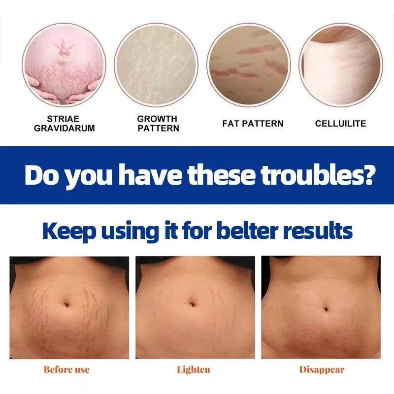 Восстанавливающий Крем для растяжек 20 г