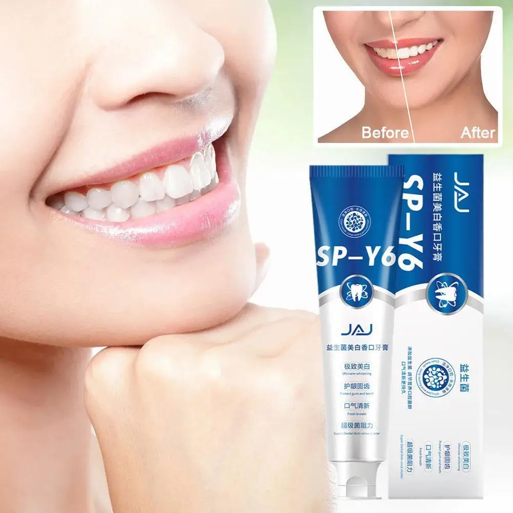 

100g Probiotic Whitening Shark Toothpaste Teeth Whitening Prevents Fresh Care Oral Plaque Toothpaste Breath Toothpaste H9Z5