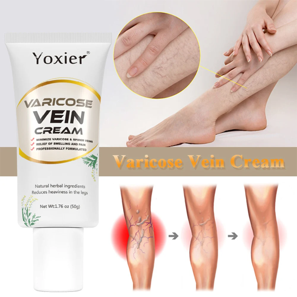 

Varicose Vein Repair Cream Soothing Pain Relief Cream Phlebitis Spider Vein Blood Circulation Improvement Body Care Cream