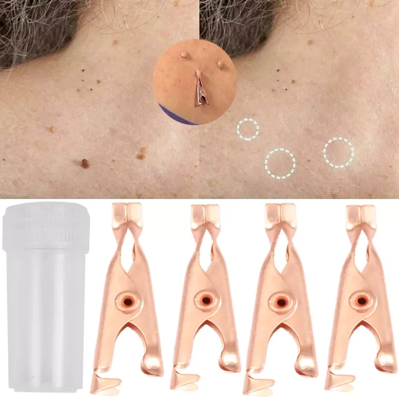 

Clip Copper Tag Remover Skin Care Wart Remover Micro Strip Cleaning Skin Tag Removal Kit Facial Beauty Makeup Tools 1/2pcs