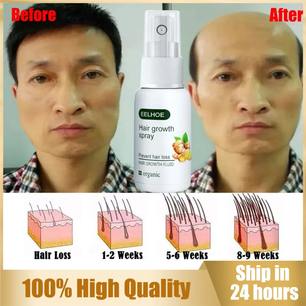 

Fast Hair Growth Spray Serum Ginger Anti Hair Loss Treatment Product Beauty Hair Care Essence Prevent Thinning Dry Frizzy Repair