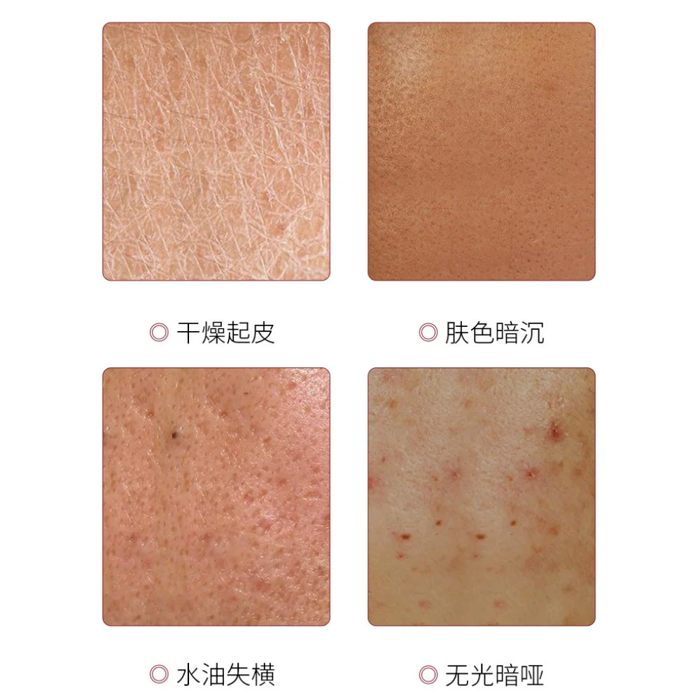Эссенция AOPY Squalane Rose хороший ночной крем сглаживание улучшение сухости