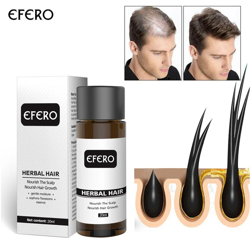 

Имбирная Бриллиантовая Сыворотка против выпадения волос, средство для восстановления фолликула кожи головы, жидкость для роста волос