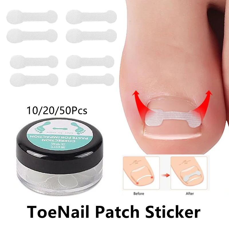 

10pcs Ingrown Toe Nail Treatment Ingrown Toenail Correction Tool Elastic Patch Sticker Straightening Clip Brace Pedicure Tools