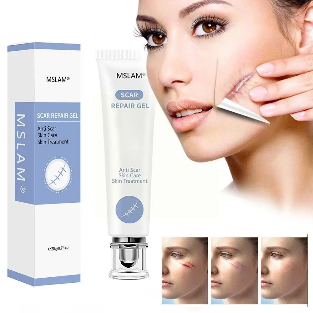 

Scar Repair Gel Removal Scar Acne Cream Treatment Marks For Face Body Pigmentation Corrector Skin D3a4