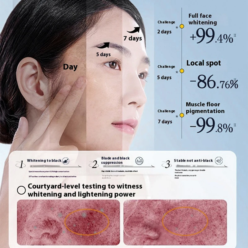 377 фенилэтил резорцинол крем для лица Уход за кожей сыворотка Набор путешествий