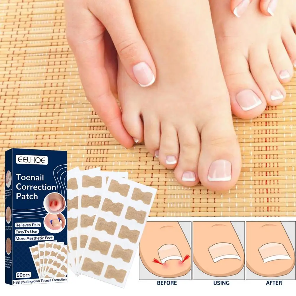 

50Pcs Toenail Patches Reduce Pain Correct Nail Growth Self-Adhesive Waterproof Breathable Glue Free Toenail Patches for Foot