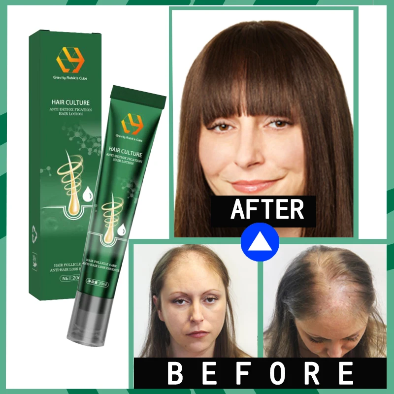 

Hair Regrowth Serum Hair Loss Biotin Fast Hair Growth Damaged Hair Repair Hair Thinning Treatment