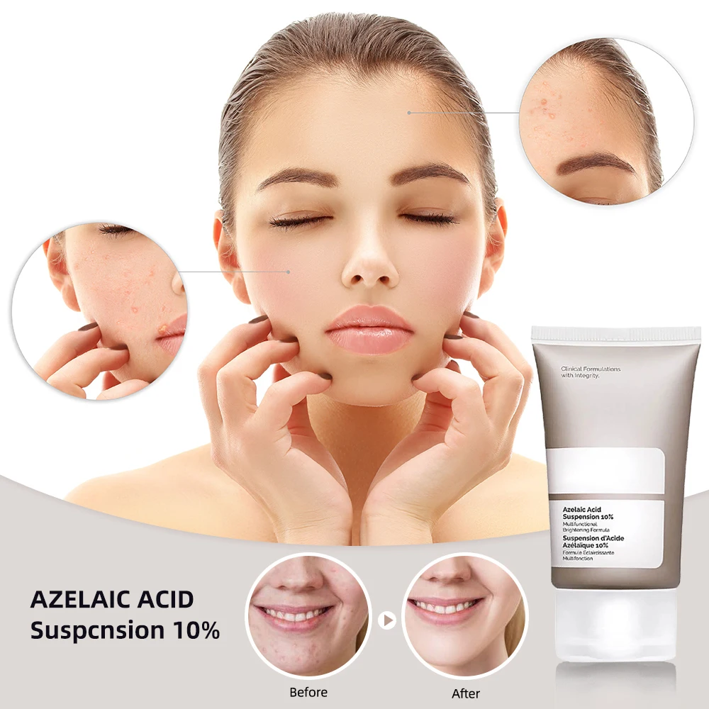 

Азелаиновая кислота 10% натуральные увлажняющие факторы + HA увлажняющий крем для лица отбеливающий укрепляющий Осветляющий Уход за кожей 30 м...