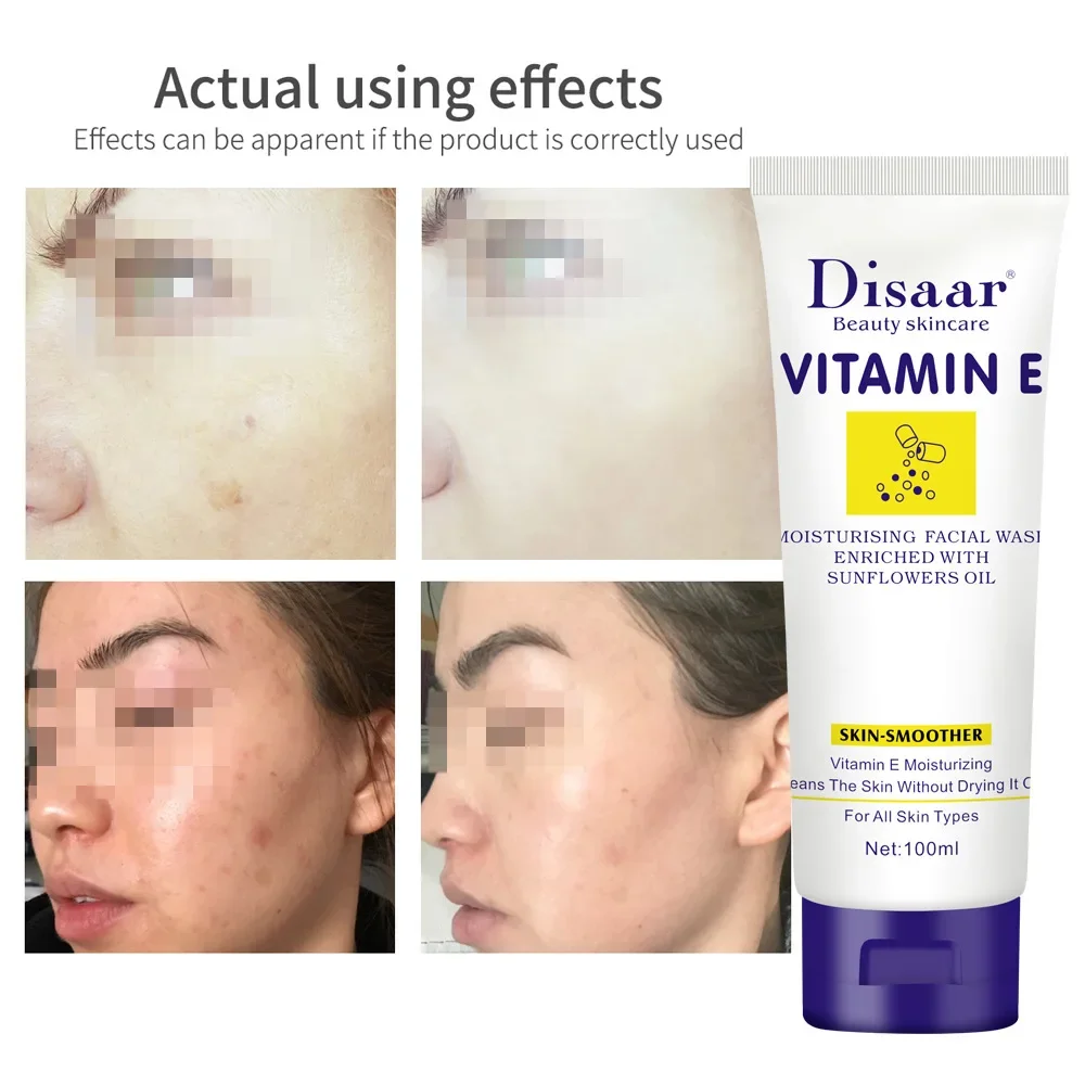 100 г Витамин Е для умывания лица очищающее грязь питательное средство контроль