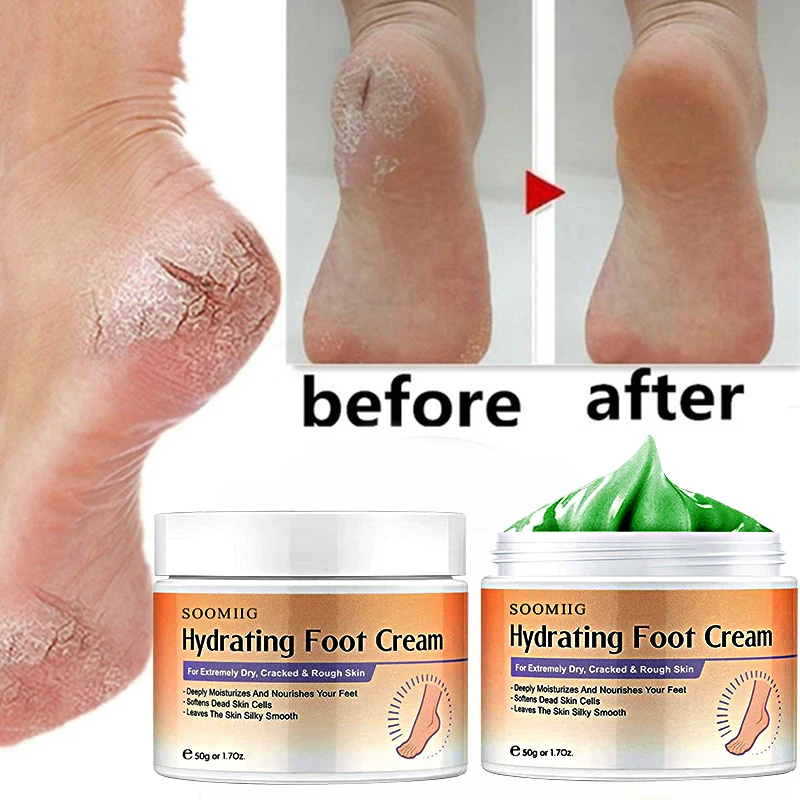 

Cracked Heel Balm Cream for Rough Dry Cracked Chapped Hand/Feet Heel Skin Care Cream Natural Essence Skin Care for Body