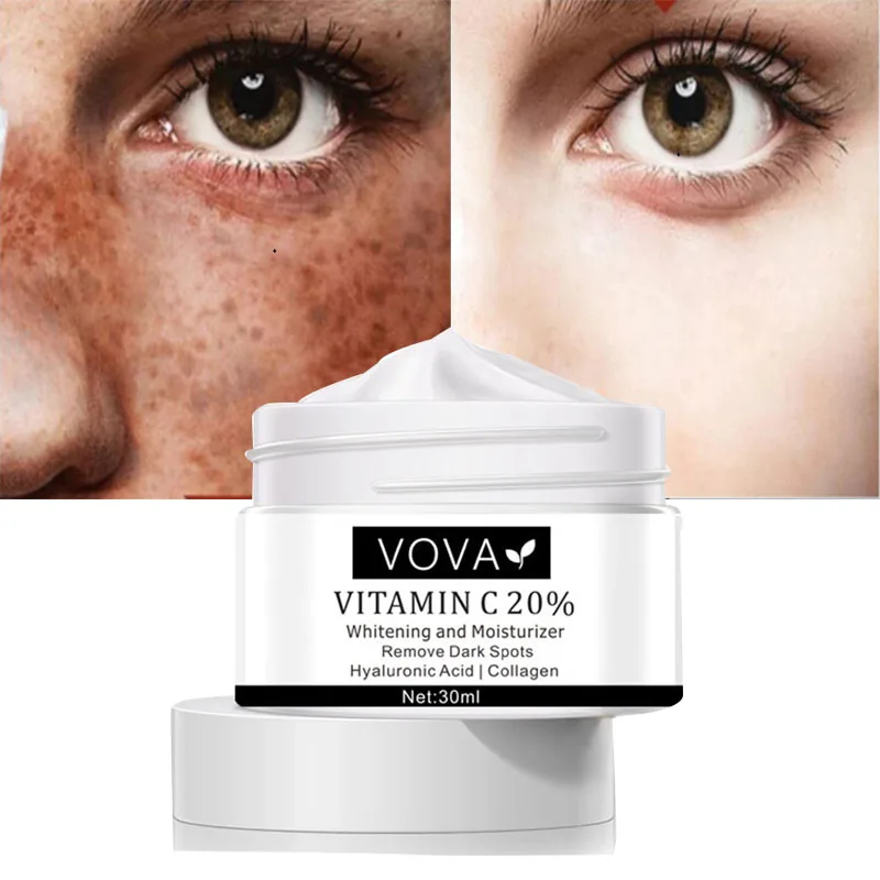 

Vitamin C Whitening Freckle Face Cream Fade Dark Spots Remove Melanin Shrink Pores Moisturizing Brighten Repair Korean Cosmetics