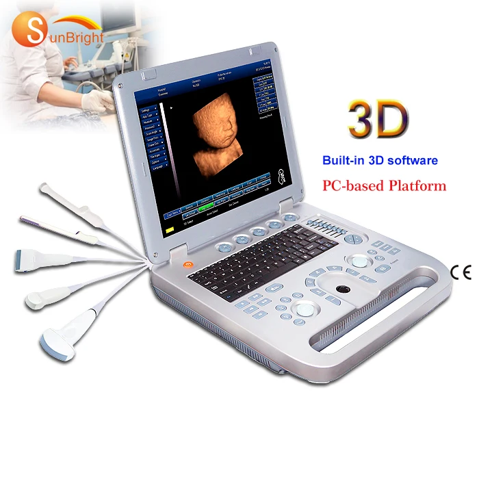 

Portable medical ultrasound instruments ecography echo doppler ultrasound 3d gynecologic / pregnancy ultrasounds machine