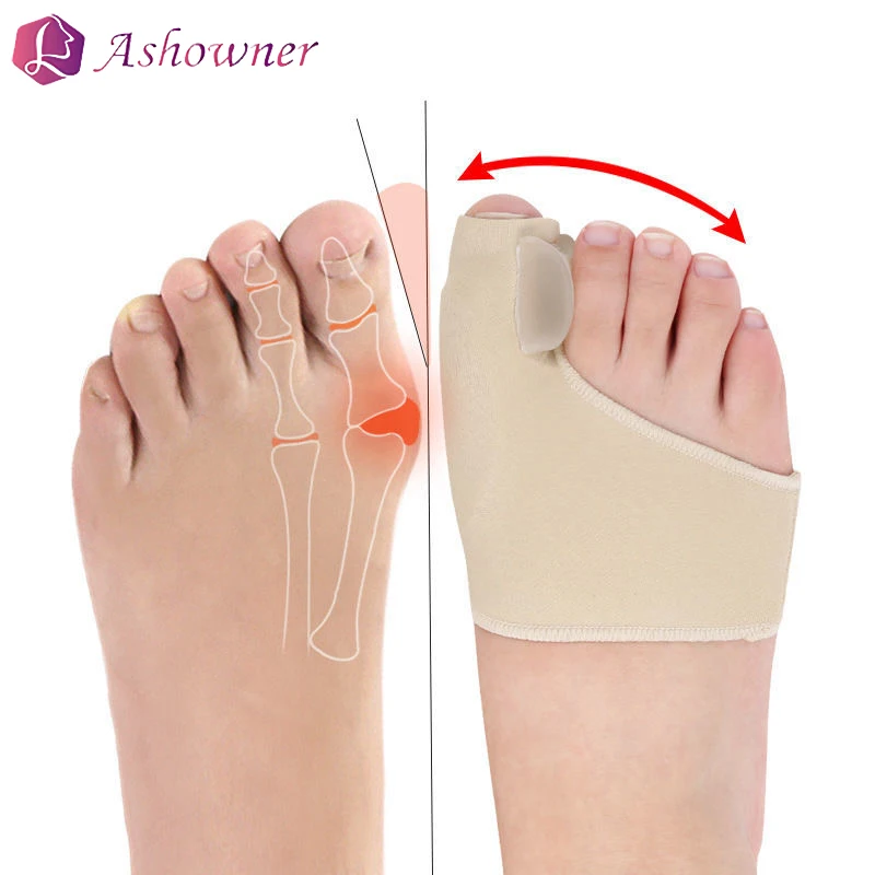 

Корректор для пальцев ног, ортопедический выпрямитель для большого пальца ноги, при вальгусной деформации