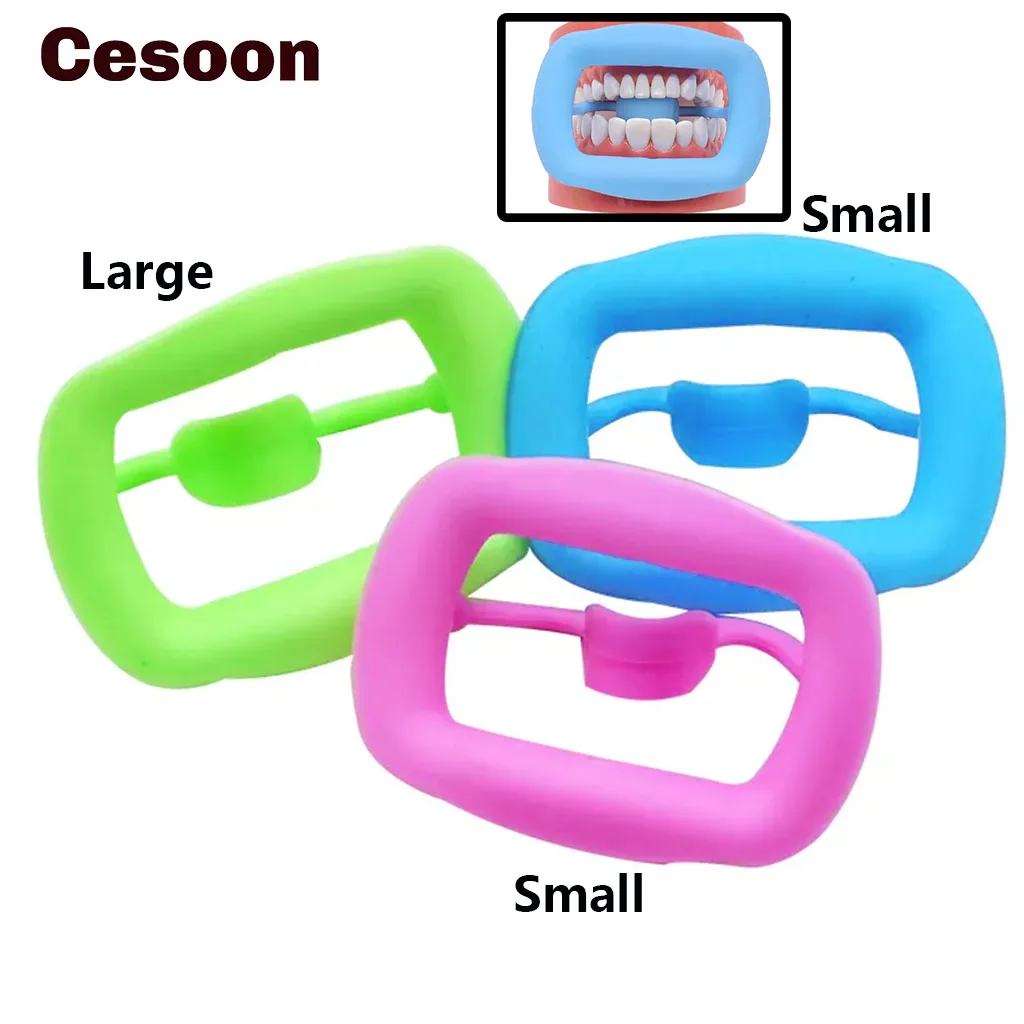 

Cesoon 1Pc Mouth Opener Dental Cheek Retracor Soft Silicone Intraoral Lip Cheek Retractor Tooth Orthodontic Oral Care Tool