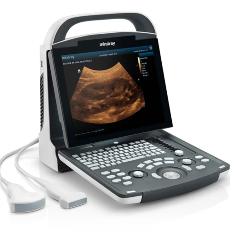 

Ultrasonic Diagnostic Imaging System Ultrasound Scanner ecografo M dp10 ultrasonic M dp 10 probe