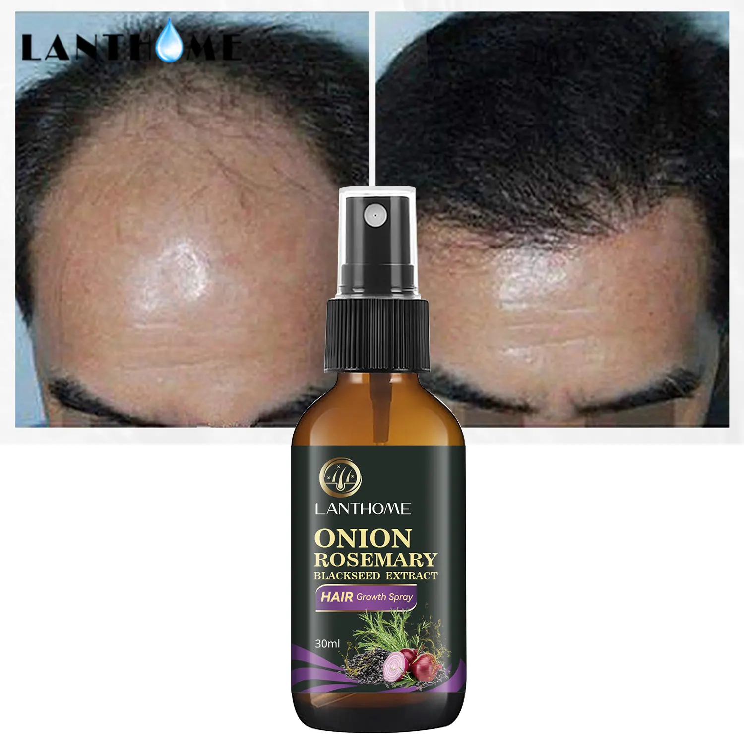 

1 Pc Fast Hair Growth Hair Follicle Treatment Rosemary Oil for Hair Growth - Effective Hair Growth Products for Men
