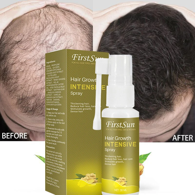 

Hair Care Hair Growth Essential Oils Essence Original Authentic 100% Hair Loss Liquid Health Care Beauty Dense Hair Growth Serum