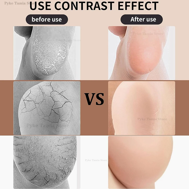 2 шт. силиконовые увлажняющие стельки для обуви против трещин