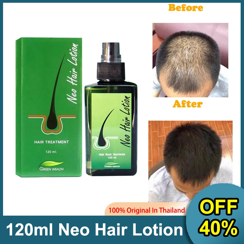 

Neo Hair Lotion Hair oil hair serum hair grow Treatment Spray 100% Original 120ml Made In Thailand Essence Oil Hair Loss for Men