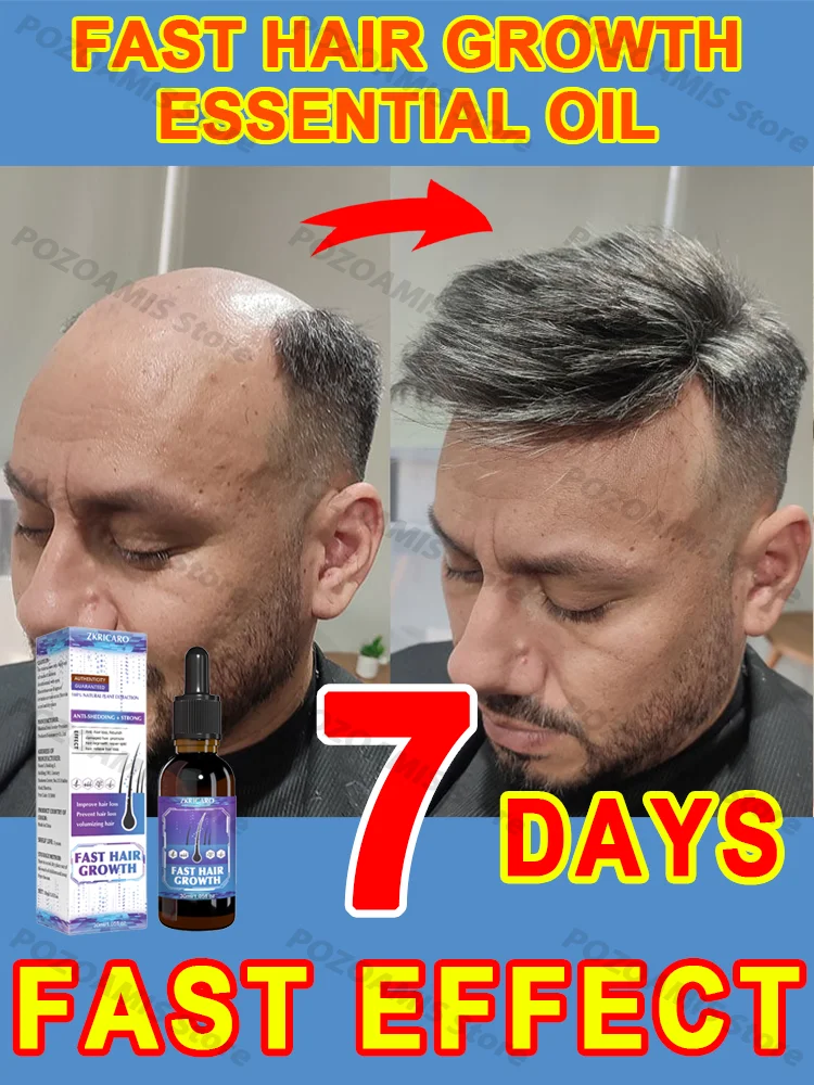 Больше и еще волосы посмотрим с полезным облысением