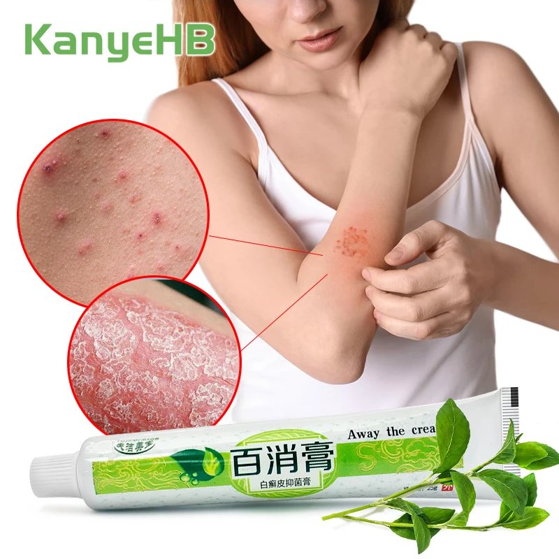 1 шт. дерматит экзема крем против зуда сыпь Beriberi Eczema от псориаза мазь эффективный