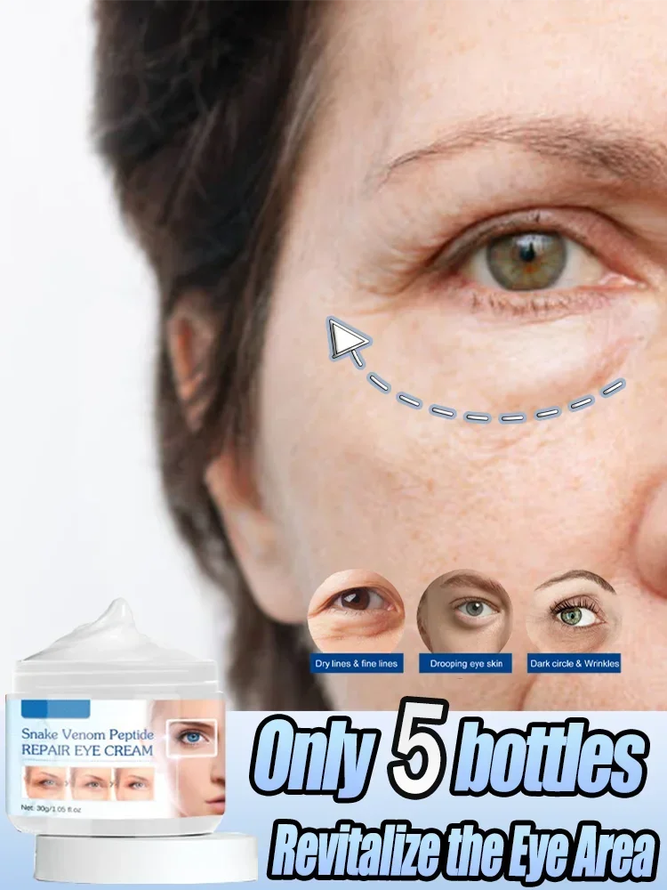 Крем для глаз Удаление отечности Осветление линий и темных кругов Увлажняющий