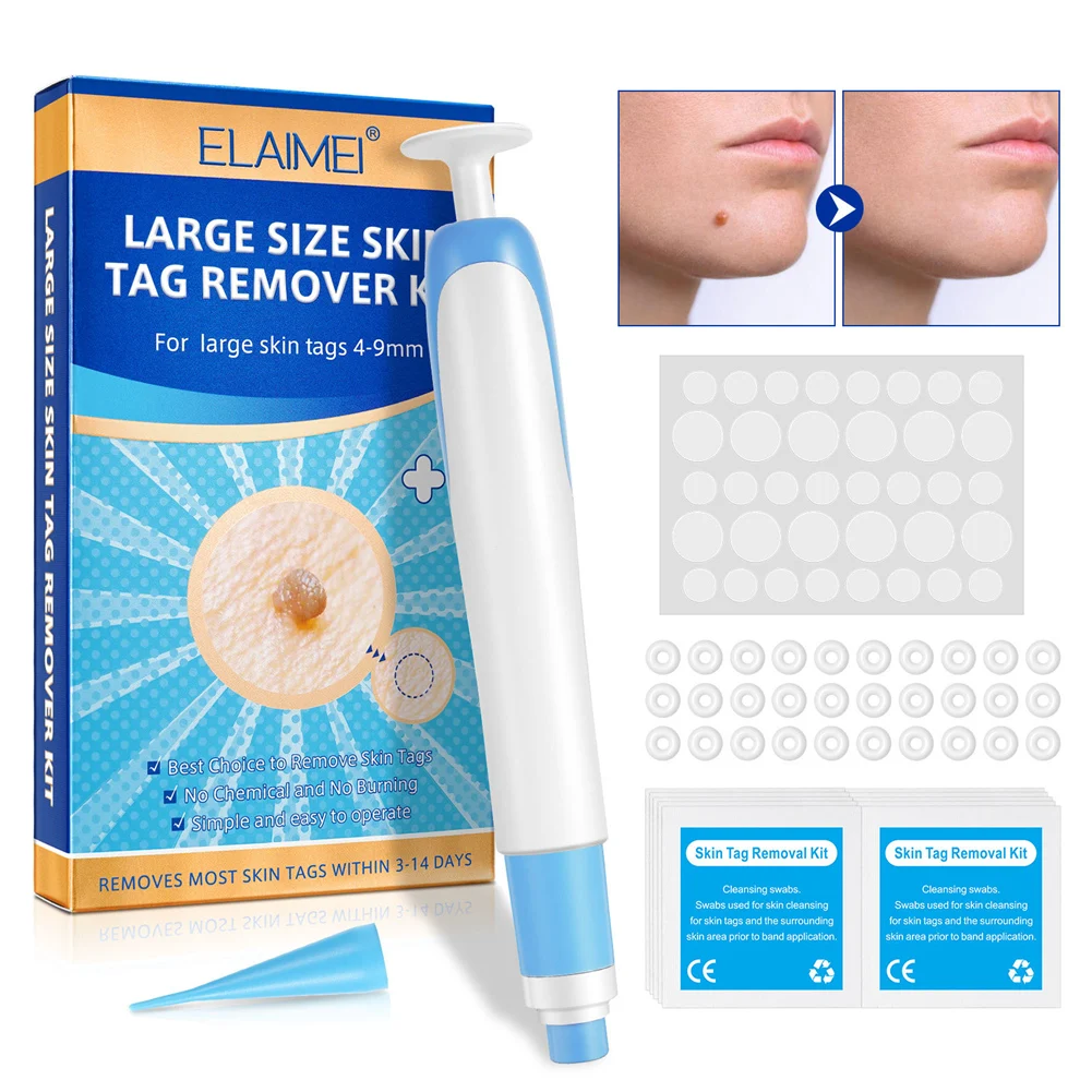

1set Auto Skin Tag Remover Tool Kit Painless Micro Skin Tag Removal Device Adult Wart Corn Flat Plantar Meat Grain Removal Tools