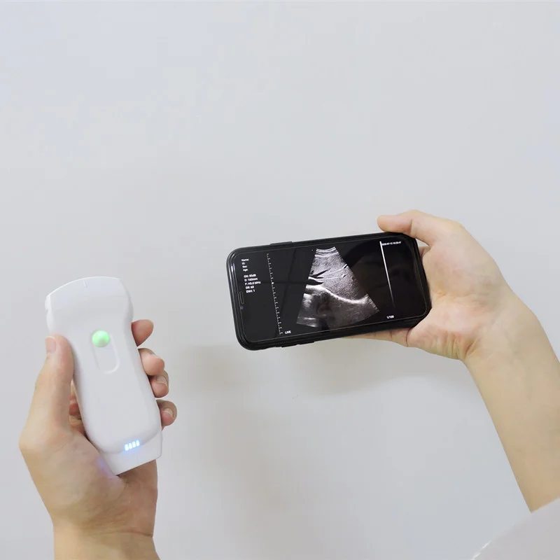 

C10RL Ultrasound Handheld Clinic Vein Finder / Scanner / Viewer / Locator / Reader with Best Price endoscope usb camera