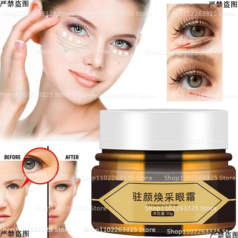

Lighten Dark Circles and Fine Lines Eye Cream Remove Eye Bags Fat Grains Lift and Tighten The Skin Around The Eyes Anti Aging