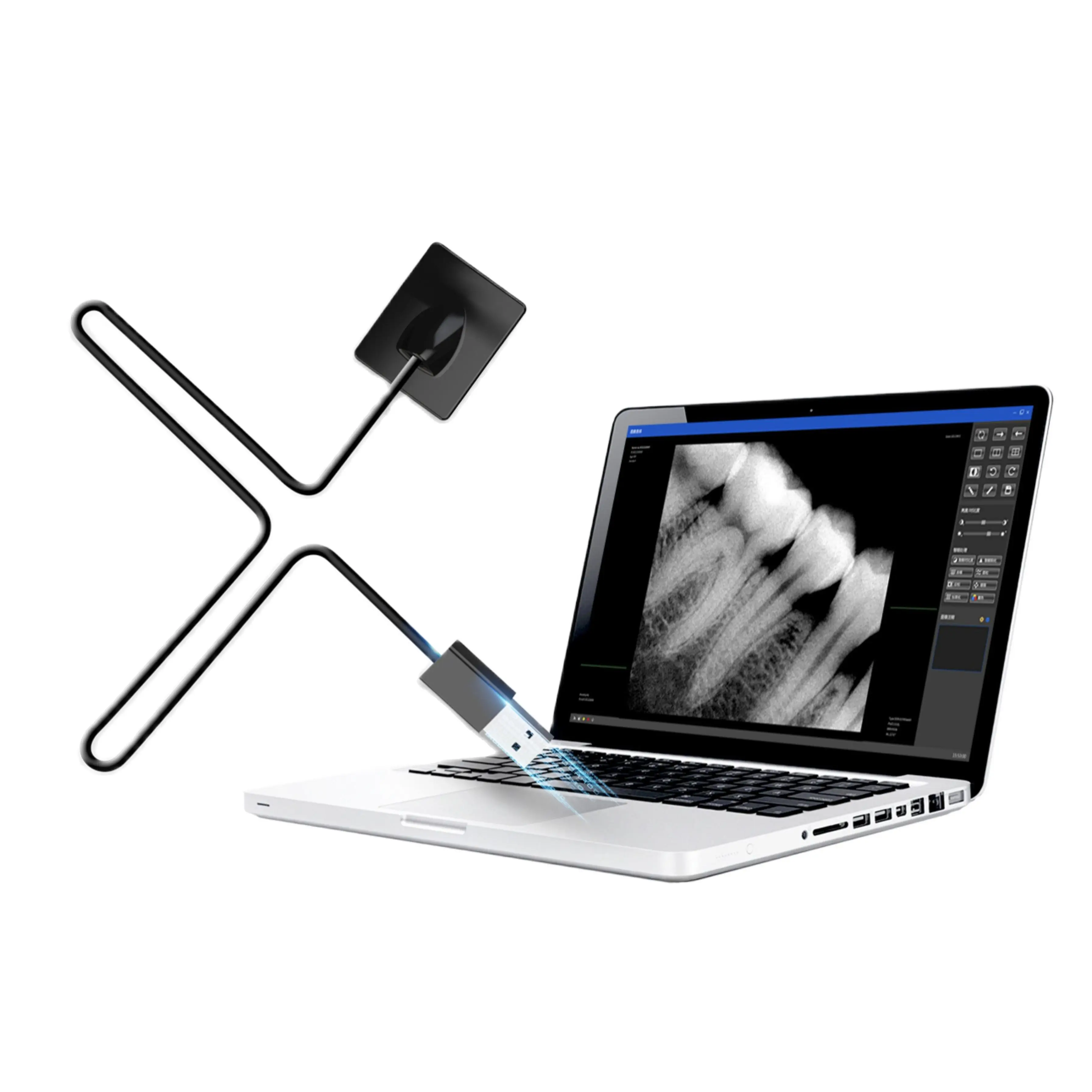 

Цифровой интраоральный датчик рентгеновского излучения с низким количеством дозировок фотонного подсчета, размер 0,8 и Размер 1,5 с датчиком позиционера