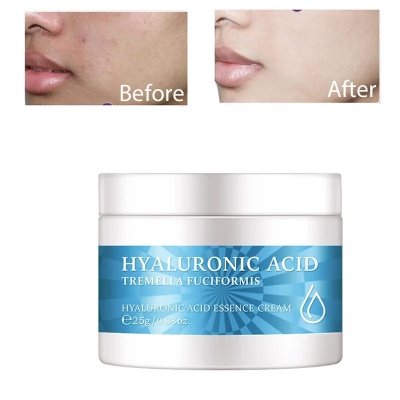 

Facial Cremas Antiarrugas Con Acido Hialurónico Para Cara Whitning Creme Clariador De Pele Whitening Cream For Women Emulsioni