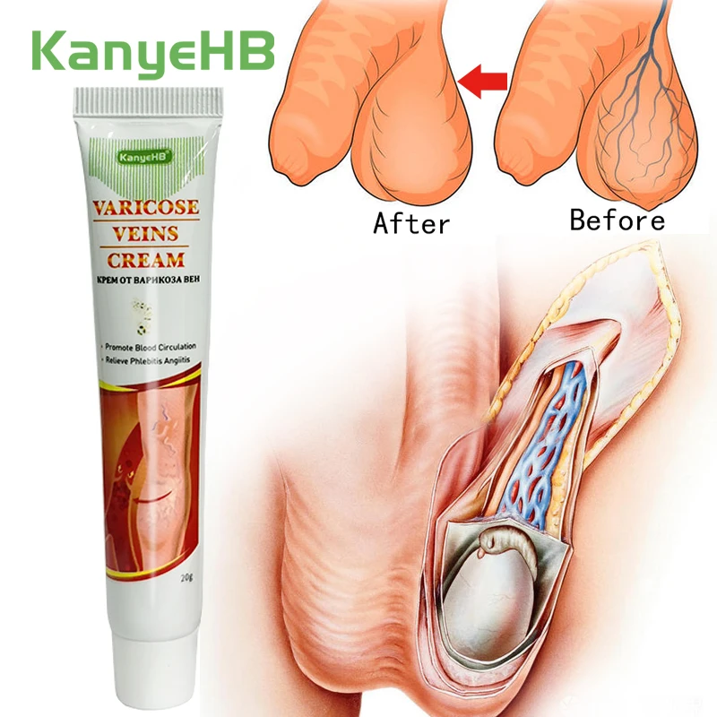 

1Pcs Varicose Veins Cream Varicocele Vasculitis Phlebitis Treatment Ointment Veins Pain Relief Medicine Cream Health Care G002