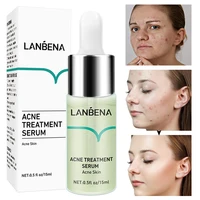 acne treatment serum moisturizing anti acne lighten acne marks soothing deep nourishment repair firming lifting face care 15ml