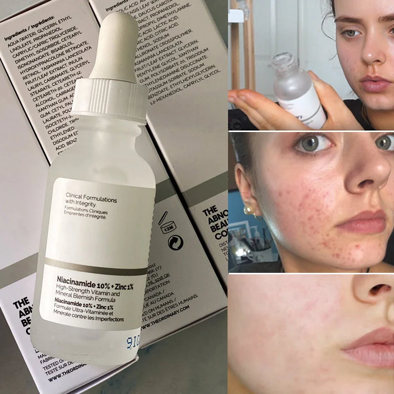 

Niacinamide 10% + Zinc 1% High Strength Vitamin And Mineral Blemish Formula Oil Control Whitening Moisturizing Serum