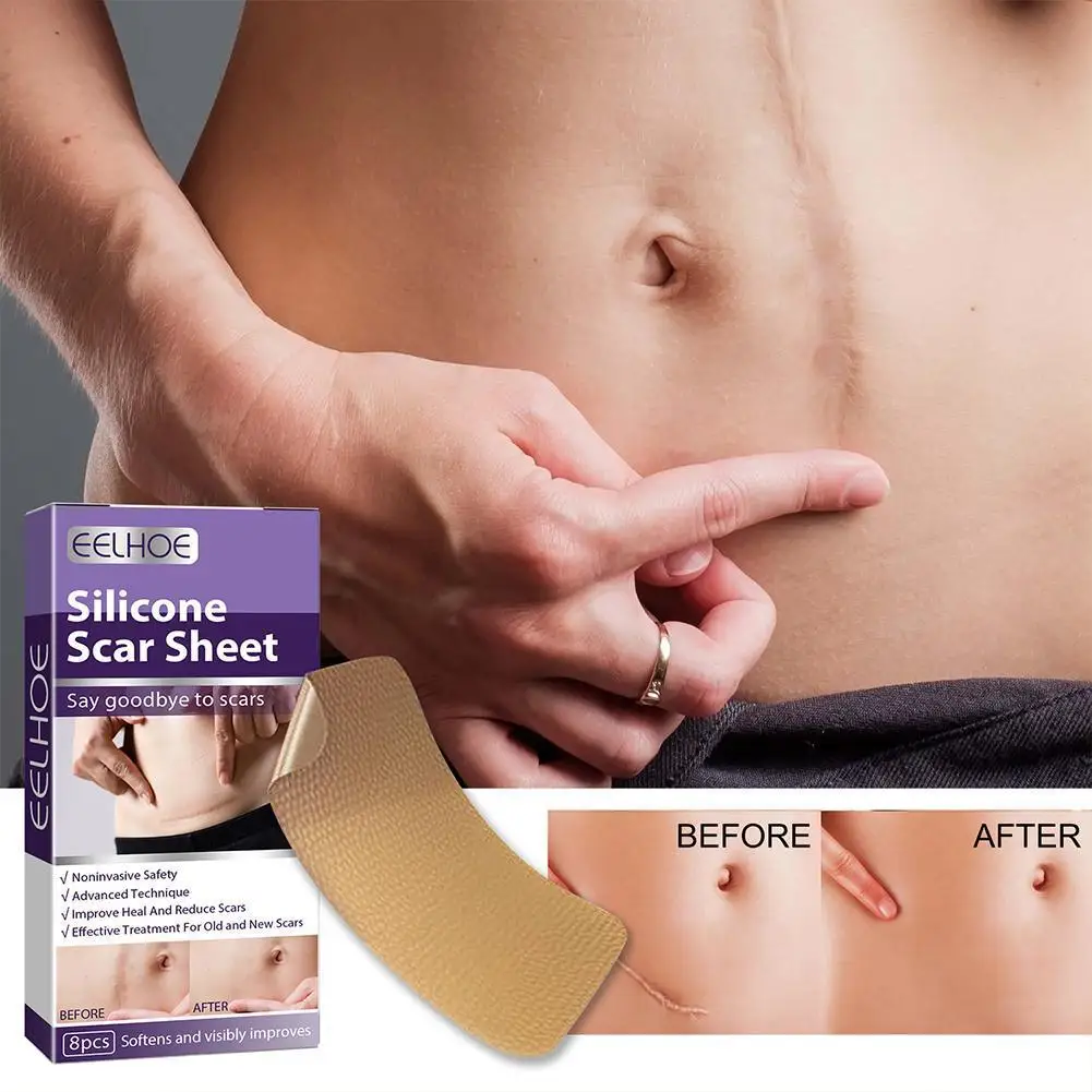 

8pcs/box Scar Repair Patch Surgery Self-Adhesive Silicone Gel Tape Removal Scar Sheets Efficient Repair Damaged Skin Sheet Care