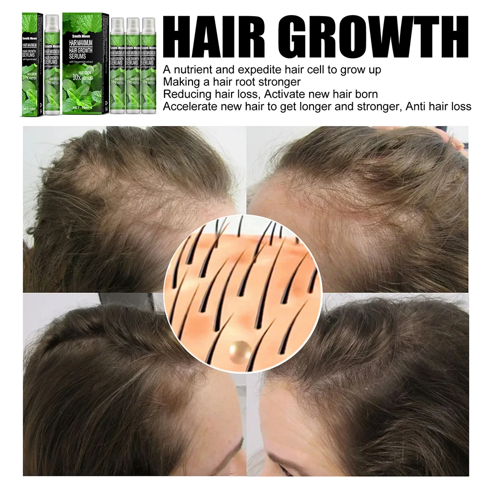 Травяная эссенция для роста волос спрей средство защиты от сухости и повреждения