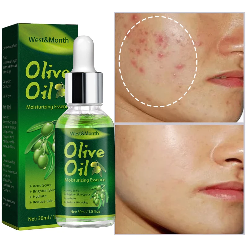 

Olive Oil Acne Removal Serum Fade Pimple Scars Oil Control Shrink Pores Acne Treatment Essence Moisturizing Whitening Skin Care