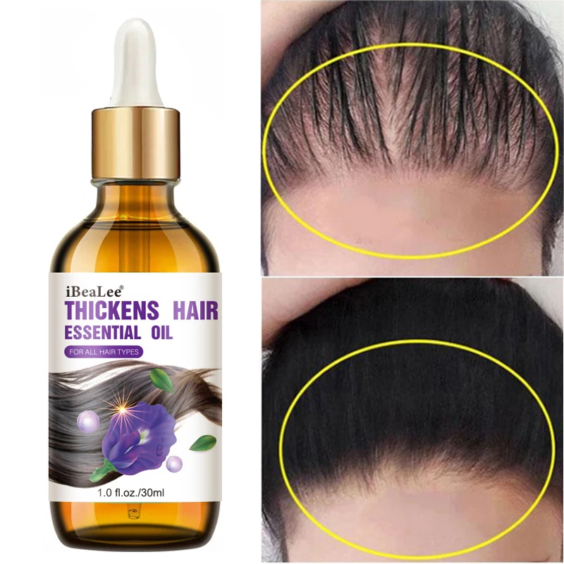 

Эссенция для быстрого роста волос сыворотка против выпадения волос, лечение кожи головы, предотвращение облысения, ремонт, питание, продукты для ухода за волосами