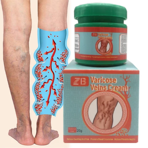 Мазь ZB для лечения васкулита 20г