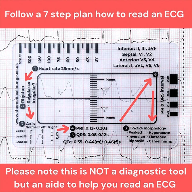 7-ступенчатая линейка Ecg карта ЭКГ-интерпретация портативный карманный