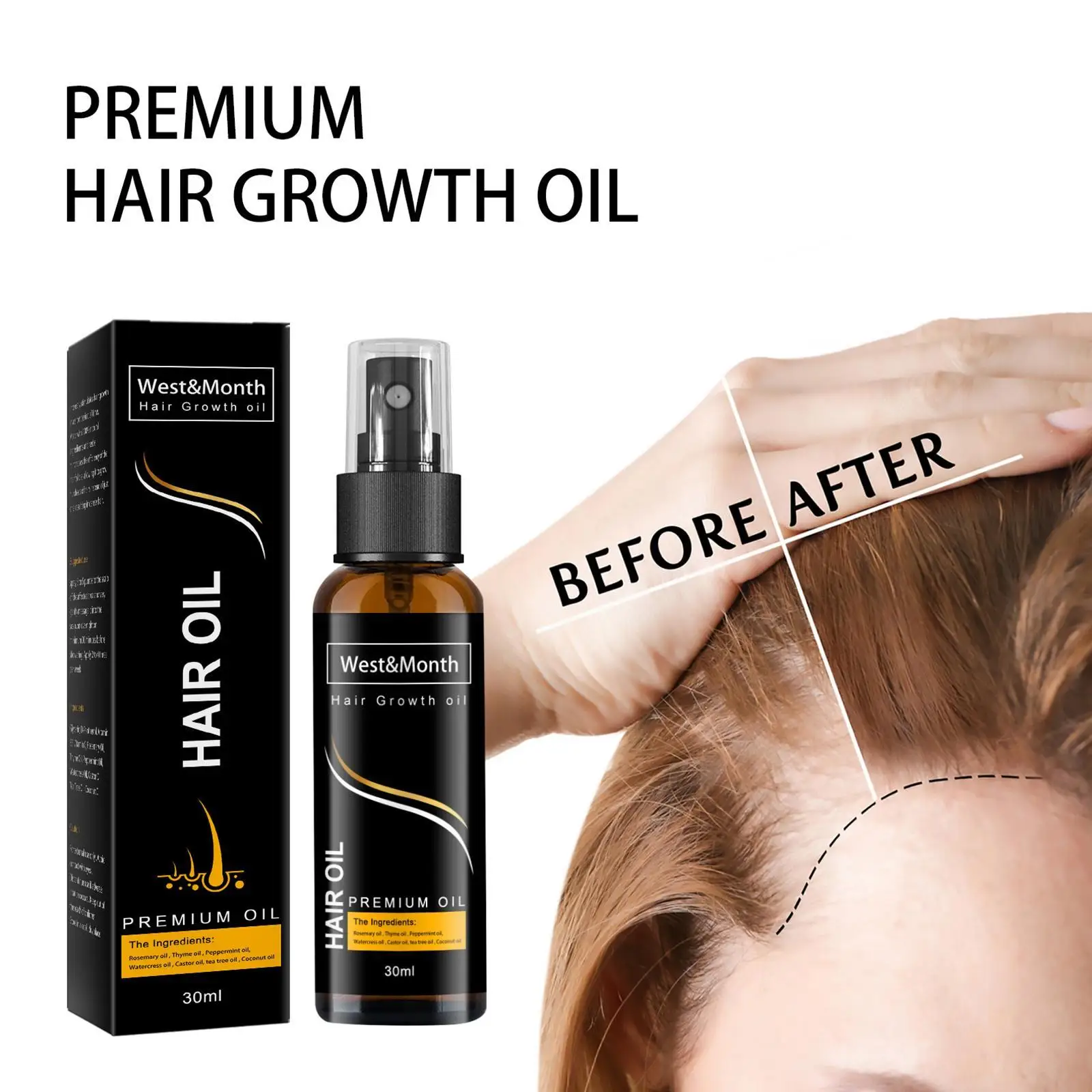 

Продукты для роста волос, Имбирная эссенция, быстрорастущее масло для волос, красота, уход за волосами, предотвращение выпадения волос, масл...